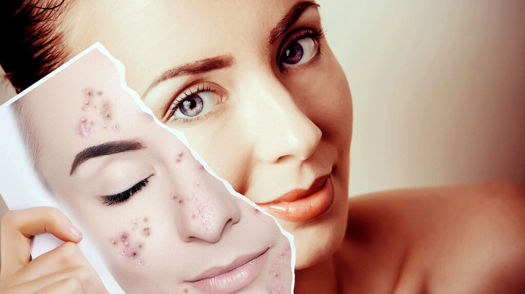 Cómo se llama el tratamiento para rejuvenecer el rostro
