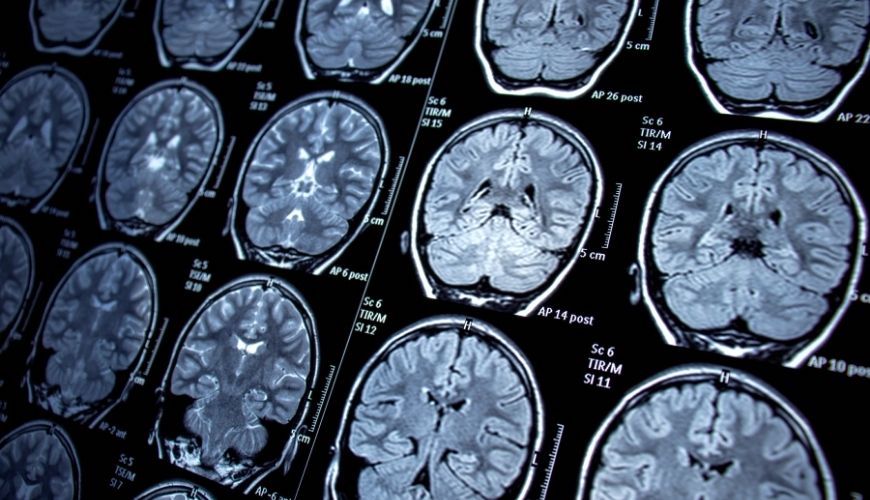 ¿Cuáles son las especialidades médicas mejor pagadas en Perú?